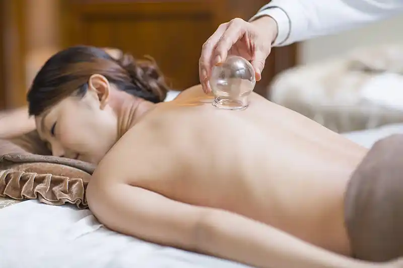 woman receiving cupping treatment